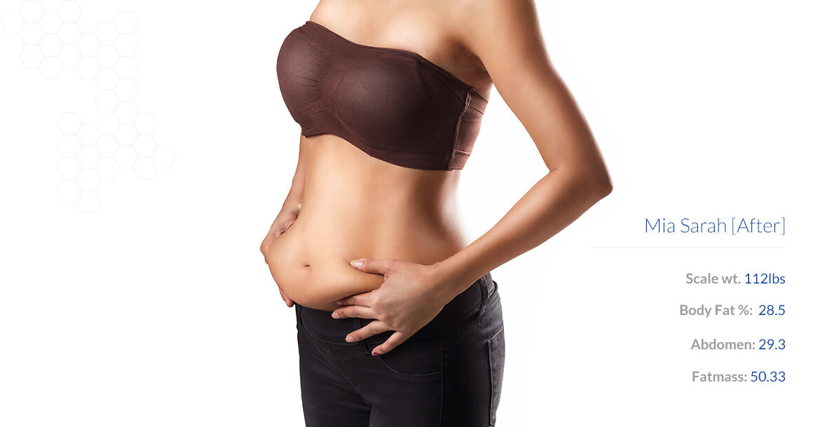 Before-شفط الدهون