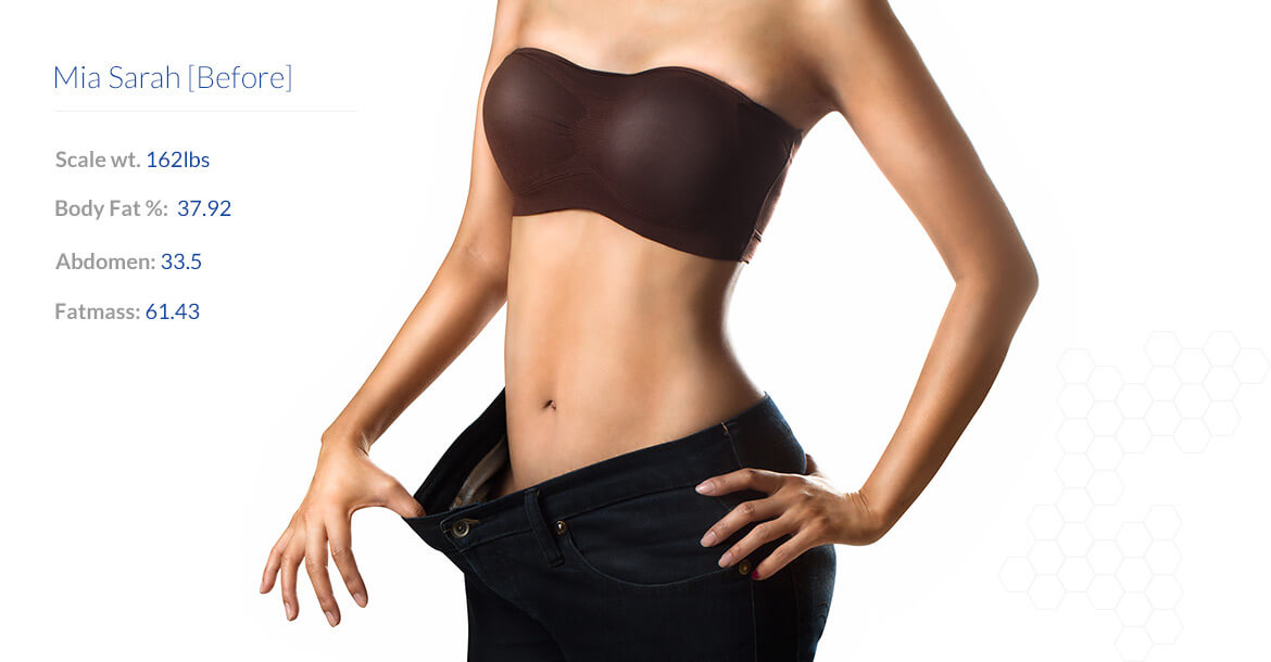 After-شفط الدهون